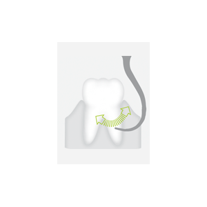 Насадка P2LD - изогнутая влево, с алмазным покрытием для обработки оголенных корней зуба - фото 1