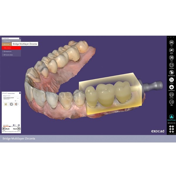 Обновления программного обеспечения для Exocad, модуль nesting (включая In-CAD Nesting) - фото 0