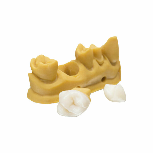 Фотополимерная смола Bego VarseoSmile Temp, для 3D-печати временных ортопедических реставраций на принтерах Varseo/Varseo L, цвет A2 - фото 2