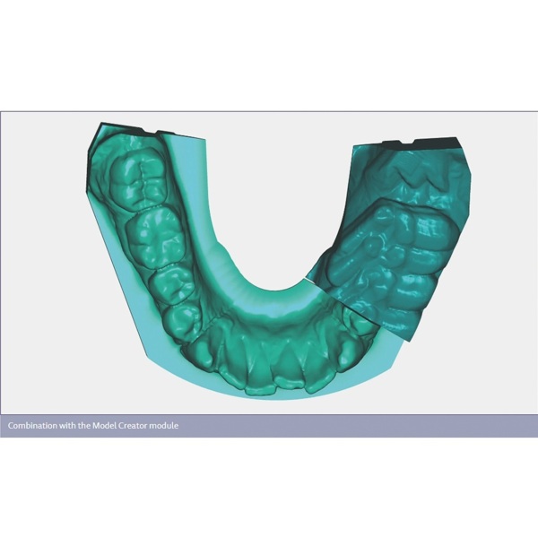 Обновления программного обеспечения для Exocad, Zebris/Jaw Motion Import - фото 1