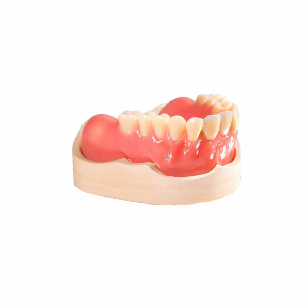 Фотополимерная смола Bego VarseoSmile Dent, для 3D-печати изготовления оснований съемных протезов, розовая, 1 кг