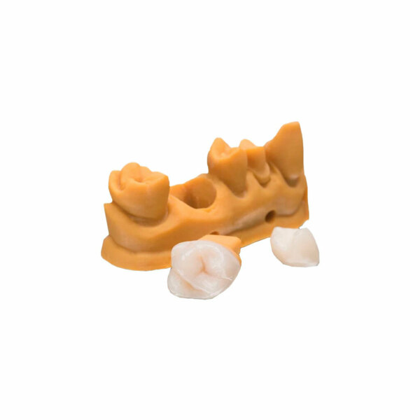 3D-принтер стоматологический Bego Varseo XS, система VarseoWax, для печати ортодонтических моделей и окклюзионных шин - фото 1