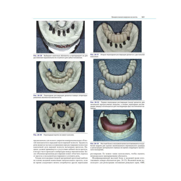 Ортопедическое лечение с опорой на дентальные имплантаты, Миш К.Е. - фото 3