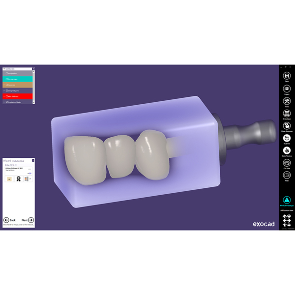 Exocad Modul In-CAD Nesting - фото 2
