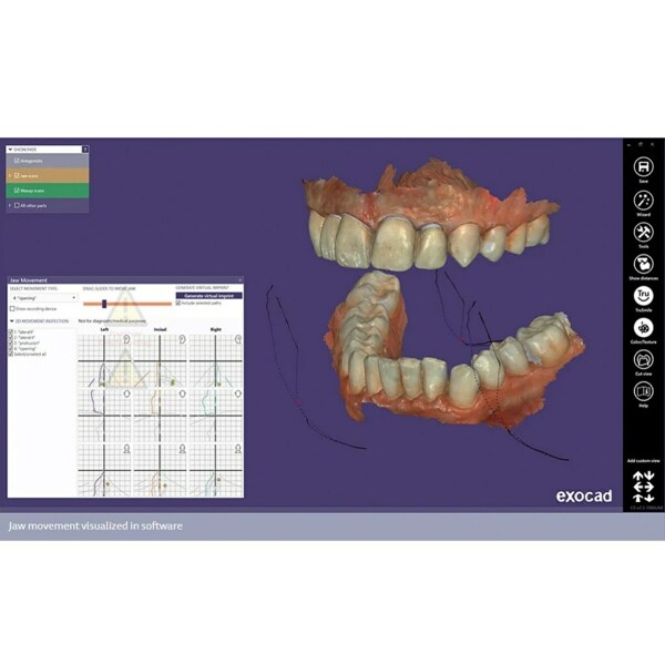 Обновления программного обеспечения для Exocad, Zebris/Jaw Motion Import - фото 0