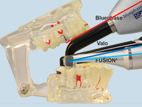 FUSION 5 CURING LIGHT Kit - лампа стоматологическая светодиодная полимеризационная - фото 1