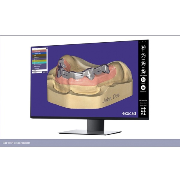 Обновления программного обеспечения для Exocad, модуль балок - фото 4