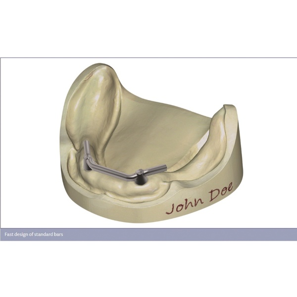 Обновления программного обеспечения для Exocad, модуль - фото 3