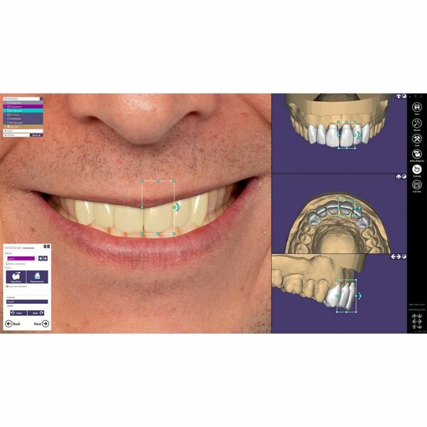 Обновления программного обеспечения для Exocad, модуль Smile Creator - фото 2