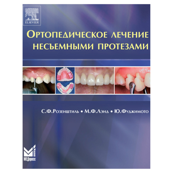 Ортопедическое лечение несъемными протезами, Розенштиль С.Ф.,Лэнд М.Ф., Фуджимото Ю. - фото 0