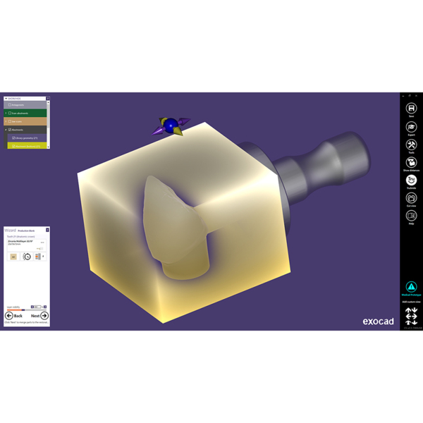 Exocad Modul In-CAD Nesting - фото 3