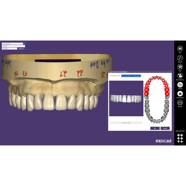Exocad Modul Tooth Library ZRS - фото 6