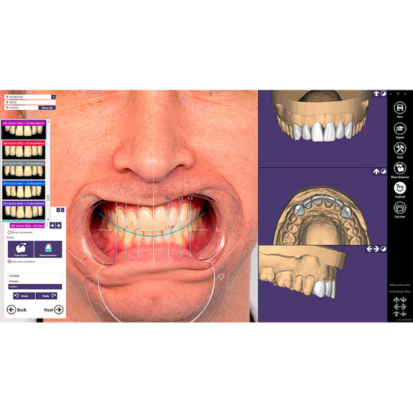 Exocad Modul Tooth Library ZRS - фото 1