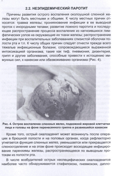 Воспалительные заболевания и механические повреждения слюнных желез, Козлов В.А. - фото 1