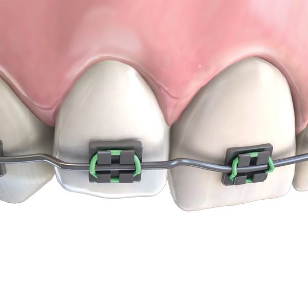 Щипцы для формирования ступенчатых изгибов, шаг изгиба 1/2 мм - фото 3