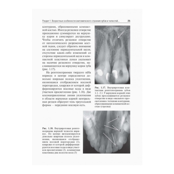 Рентгеноанатомия и рентгенодиагностика в стоматологии, В. П. Трутень - фото 5