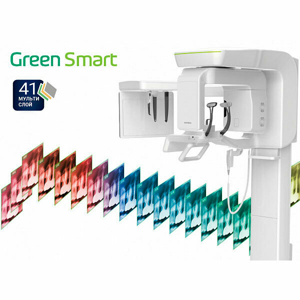 Компьютерный томограф Green Smart - фото 3