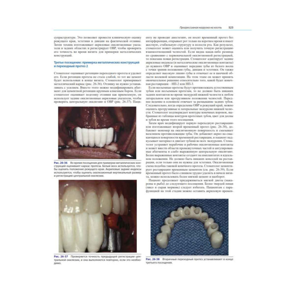 Ортопедическое лечение с опорой на дентальные имплантаты, Миш К.Е. - фото 4