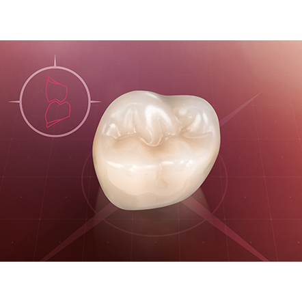 Зубы VITAPAN CUSPIFOR 3D-MASTER, жевательные (цвет и форма на выбор), 1 гарнитур/6 зубов - фото 1
