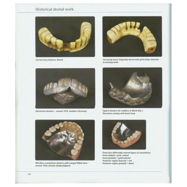 Precision milling and partial denture constructions, Henning Wulfes (английский язык) - фото 4