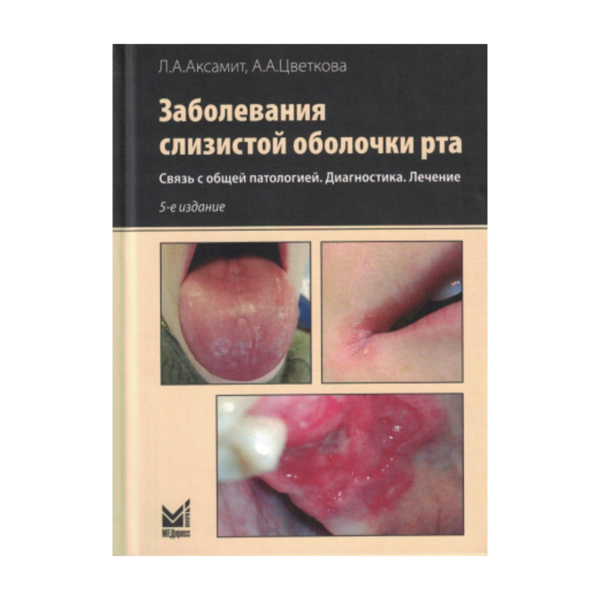 Заболевания слизистой оболочки рта. Связь с общей патологией. Диагностика. Лечение, Аксамит Л.А. Переиздание - фото 0