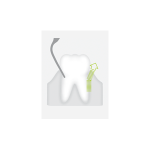 Насадка P1 - для удаления поддесневых отложений - фото 1