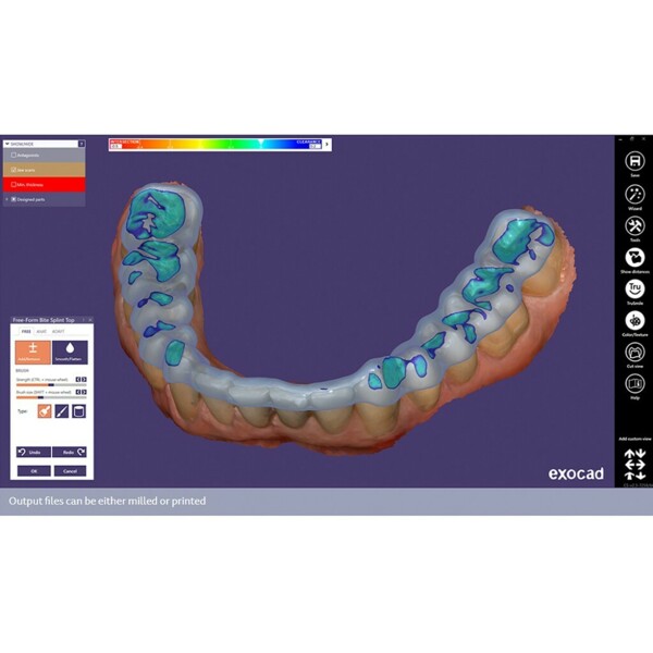 Обновления программного обеспечения для Exocad, модуль окклюзионной шины - фото 2