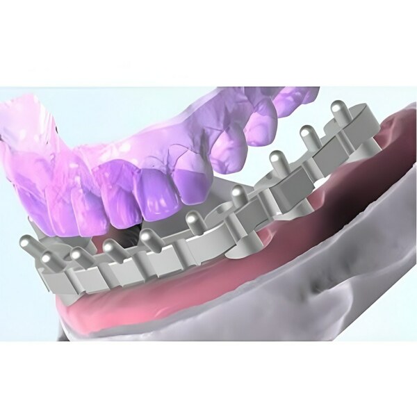 Обновления программного обеспечения для Exocad, модуль балок - фото 1