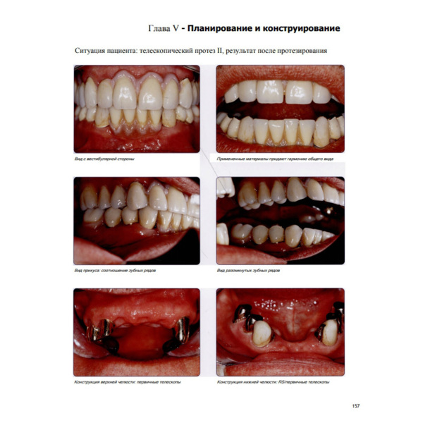 Современные технологии протезирования, Хэннинг Вульфес - фото 2