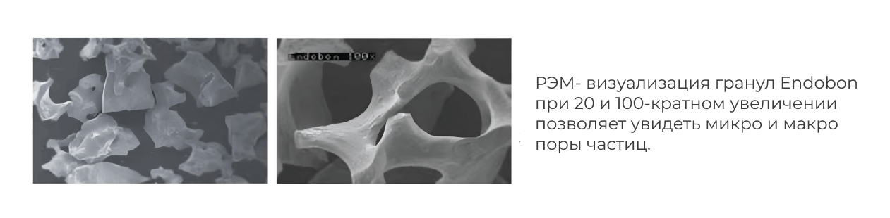 визаулизация гранул Biomet 3i Endobon