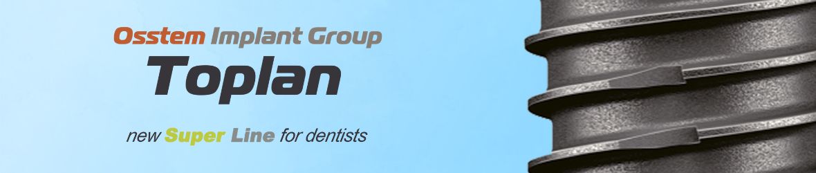 Имплантационная система Toplan: надежность OSSTEM в каждом импланте