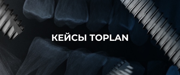 Кейсы Toplan: клинический опыт применения имплантационной системы