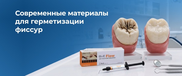 Современные материалы для герметизации фиссур