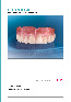 Обложка инструкции Зубы VITA PHYSIODENS classical A1 – D4, фронтальные из MRP композита (цвет и форма на выбор), 1 шт