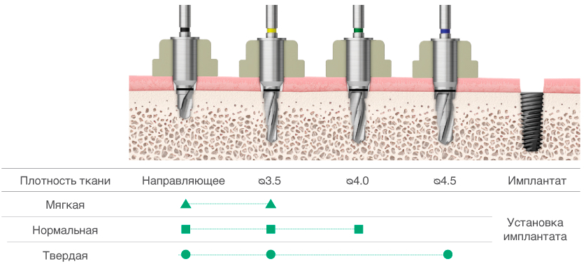 Сверло OneGuide Drill-2