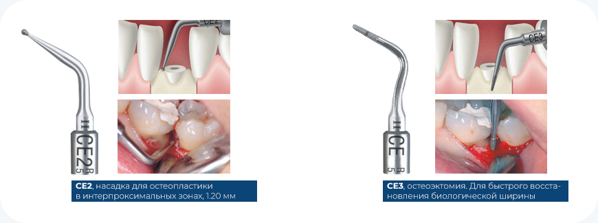 Nabor_hirurgicheskij_Acteon_Crown2