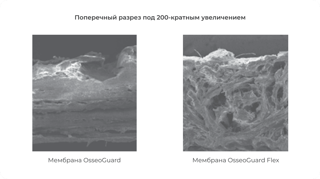 поперечный разрез мембраны Biomet 3i OsseoGuard