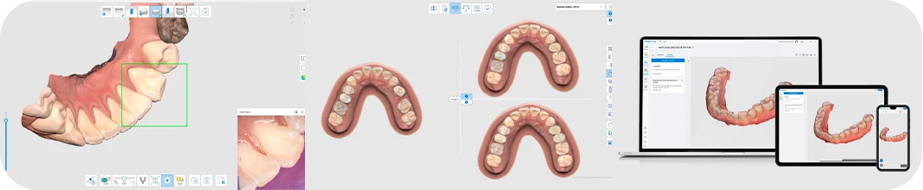 Skaner_intraoralnyj_Medit_i700_Refurbished3