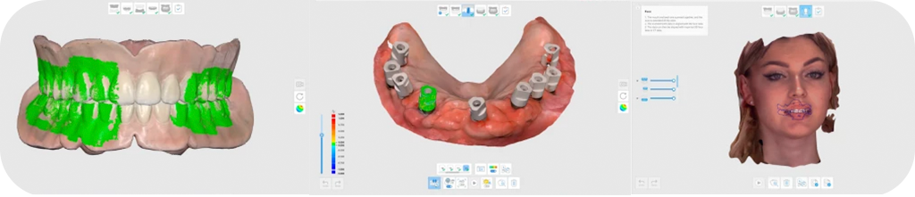Skaner_intraoralnyj_Medit_i700_Refurbished4