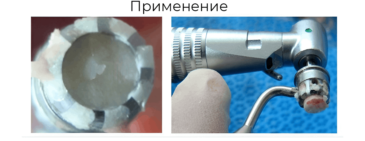 sepa