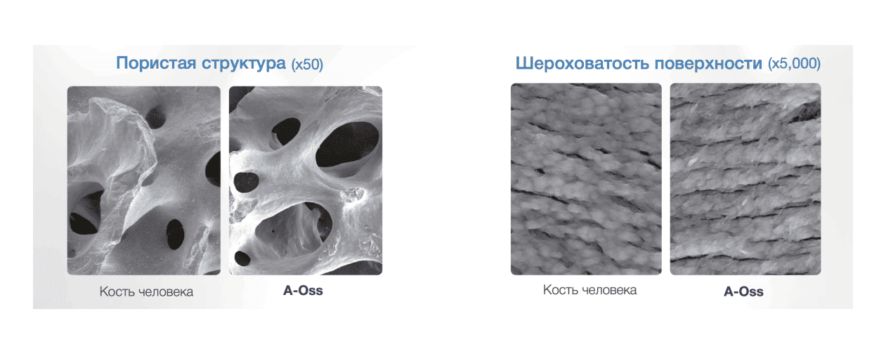 структура ксенографта бычьего OSSTEM A-Oss