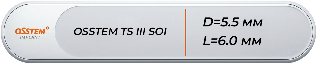 BTS3S5506A
