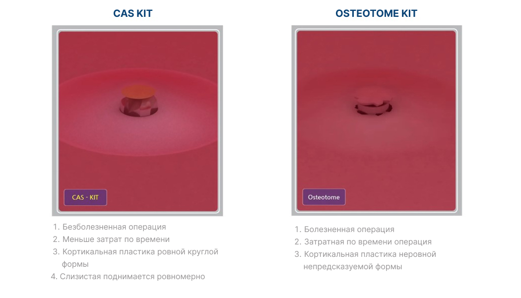 CAS KIT-6