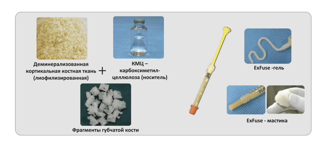 состав костного матрикса OSSTEM ExFuse II