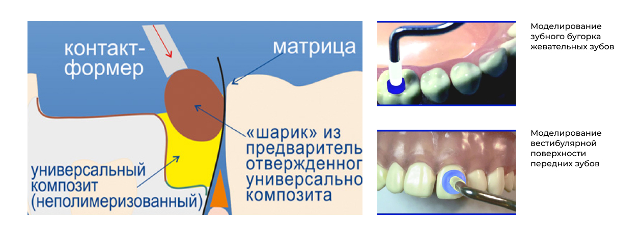 контакт-формер