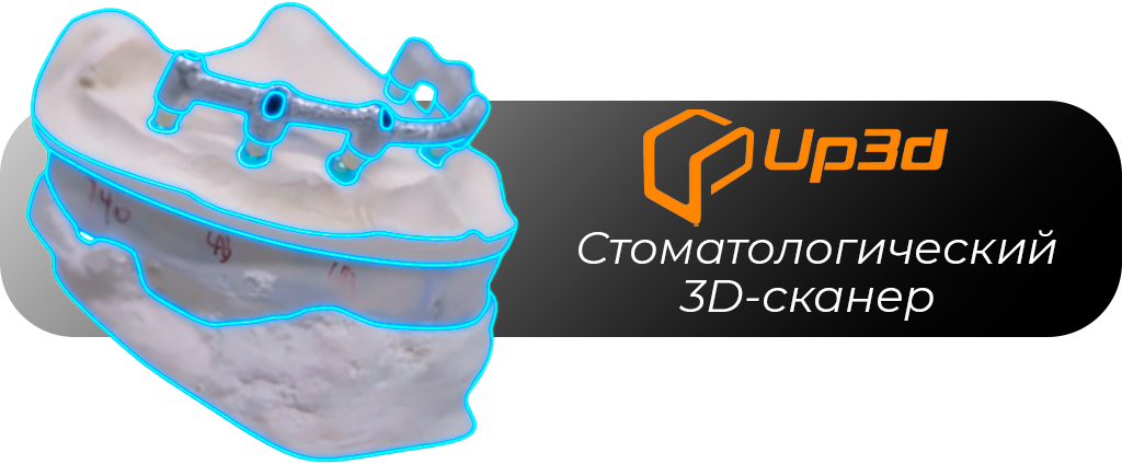 Laboratornyj3D_skaner_UP1000
