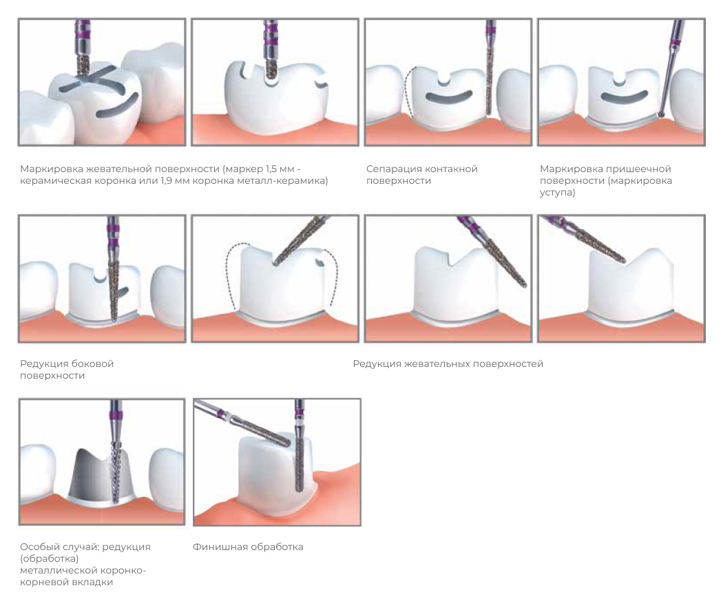 VERDENT-набор ZAVADKA